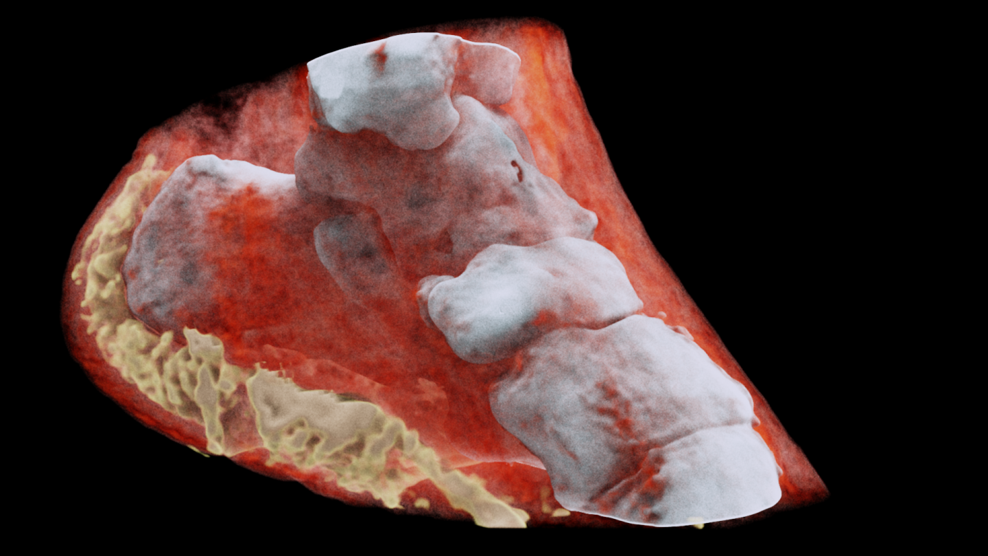 Unlike traditional CT scans, the Spectral CT scanner can separate different materials by splitting the wavelengths of X-rays