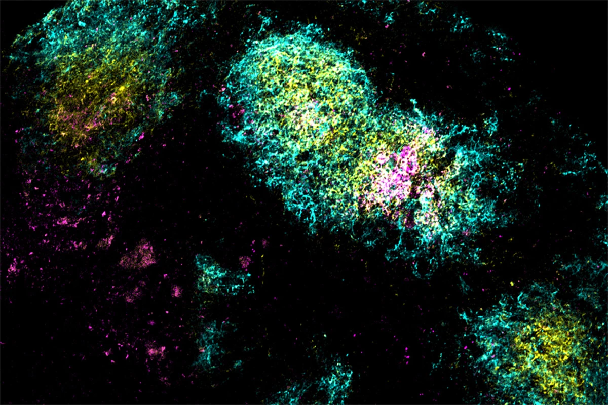The vaccine antigen (pink) being concentrated in a germinal center (yellow) within B cell follicles (cyan), triggered by the researchers’ combination adjuvant vaccine