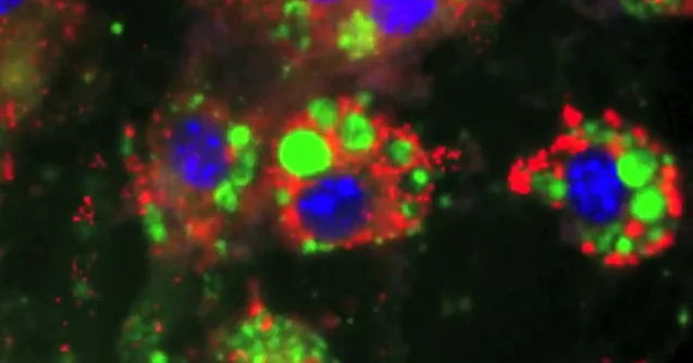 Fat cells stained with fluorescent dye