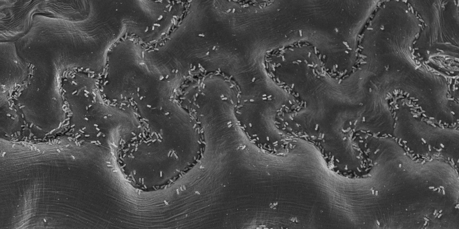 This bustling bacterial metropolis is located on a leaf, and it might just help us discover new antibiotic candidates
