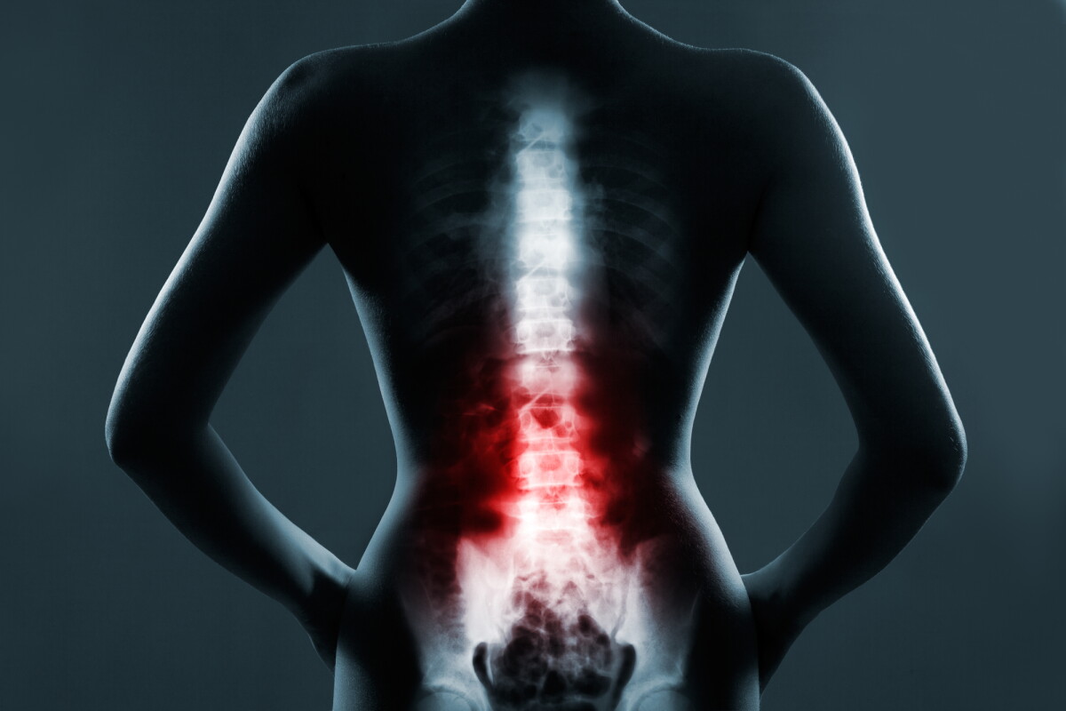 New research details 13 cases suggesting an experimental stem cell therapy is both safe and effective in treating spinal cord injury