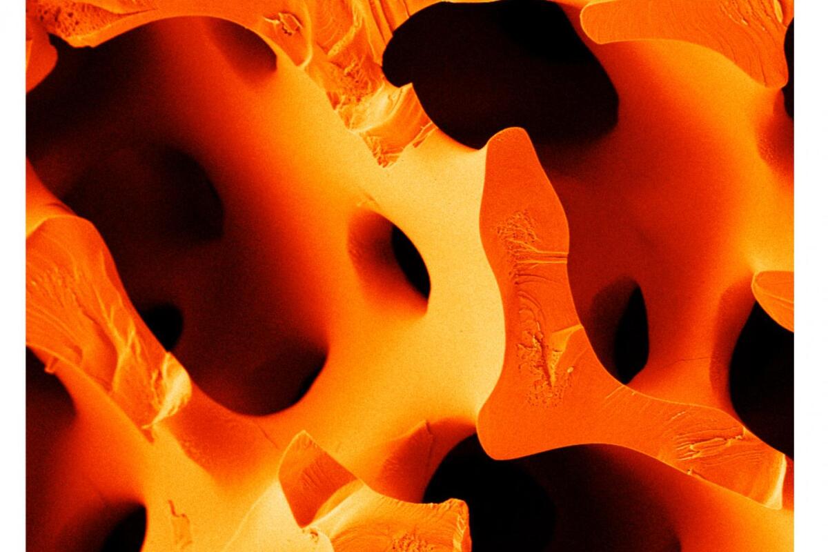 A close examination of the structure of sea urchin spines inspired researchers to find a way to create a new, more flexible type of cement