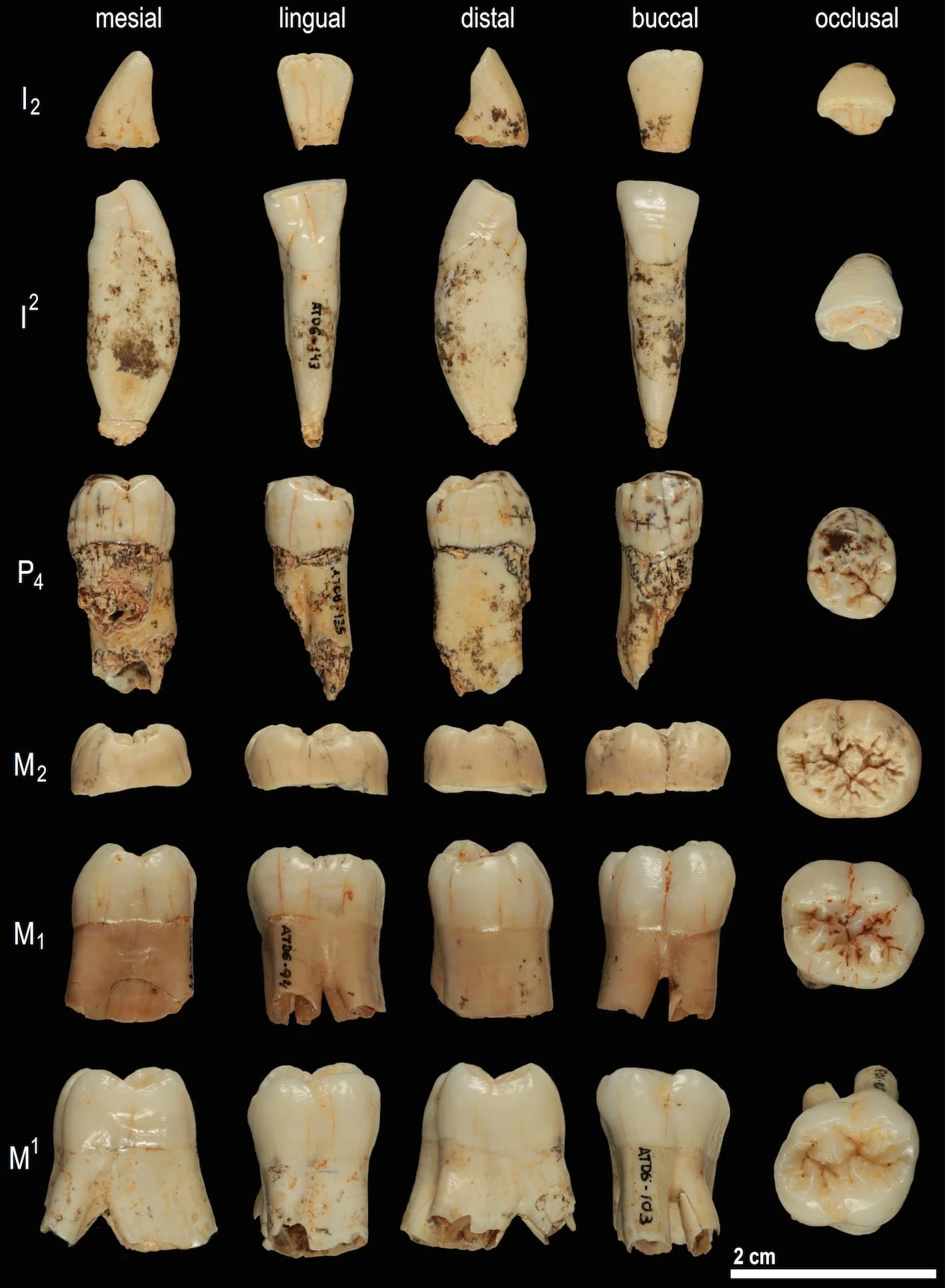 A tooth from Homo antecessor was studied using palaeoproteomics