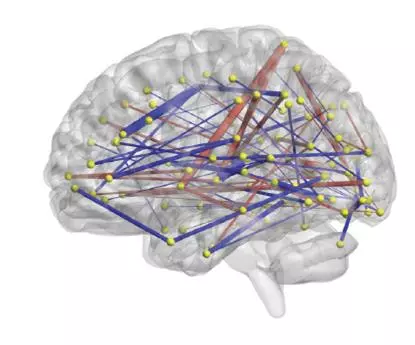 An illustration of the 200 different connections the researchers studied to predict a baby's onset of autism