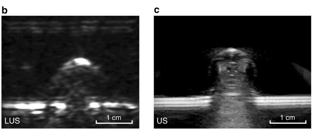 Early test image of gelatin mold with steel rod. Laser ultrasound on the left, traditional ultrasound on the right