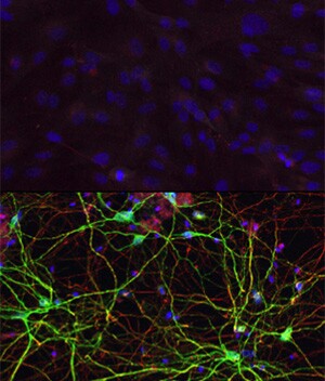 By exposing human skin cells (top) to a combination of microRNAs and transcription factors, the researchers were able to create medium spiny neurons (bottom) (Image: Yoo Lab/Washington University at St Louis)