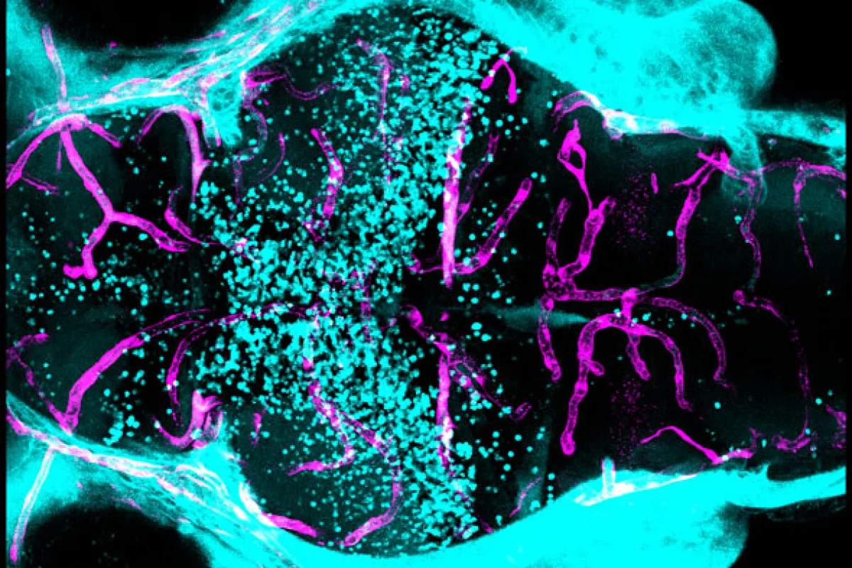 Zebrafish Dye Injection Study identifies genetic signal that controls the blood-brain barrier