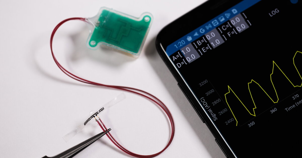 Bladder sensor sends 'pee-time' alerts to patients' smartphones