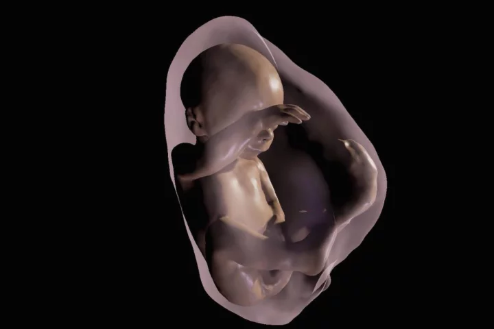 A 3D virtual model MRI view of a fetus at 26 weeks