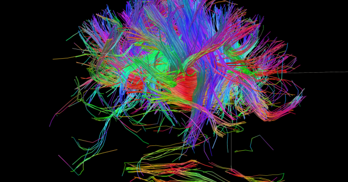 Can We Build A Complete Wiring Diagram Of The Human Brain Wiring Diagram Of The Human Brain, Brain Wiring Diagram