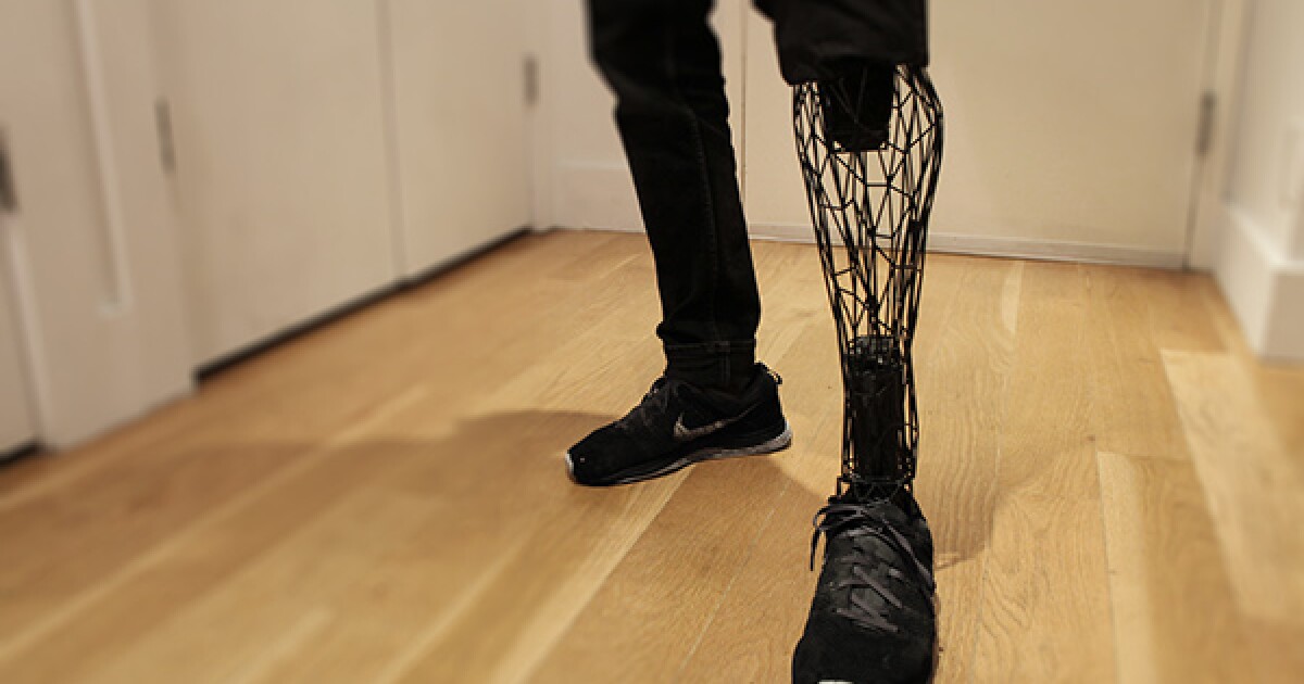 3d Printed Exo Prosthetic Leg Designed To Be Affordable And Beautiful