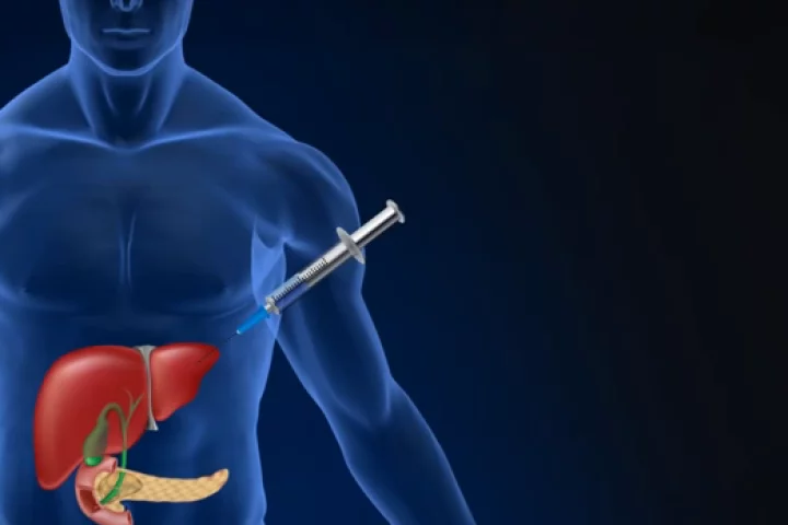 Orgenesis' approach involves harvesting the patient's own liver cells and converting them into insulin-producing cells