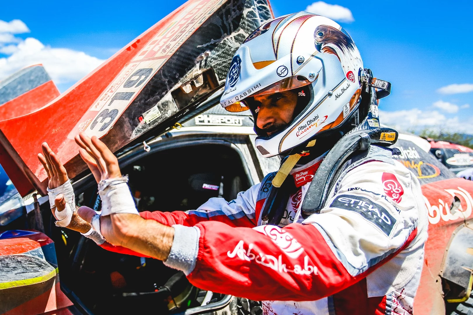 The blistered, bandaged hands of Peugeot's Sheikh Khalid A-Qassimi after Stage 12