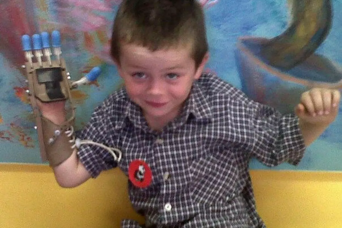 Liam impressed his doctors and classmates alike with his "Robohand," which was created by Ivan Owen and Richard Van As
