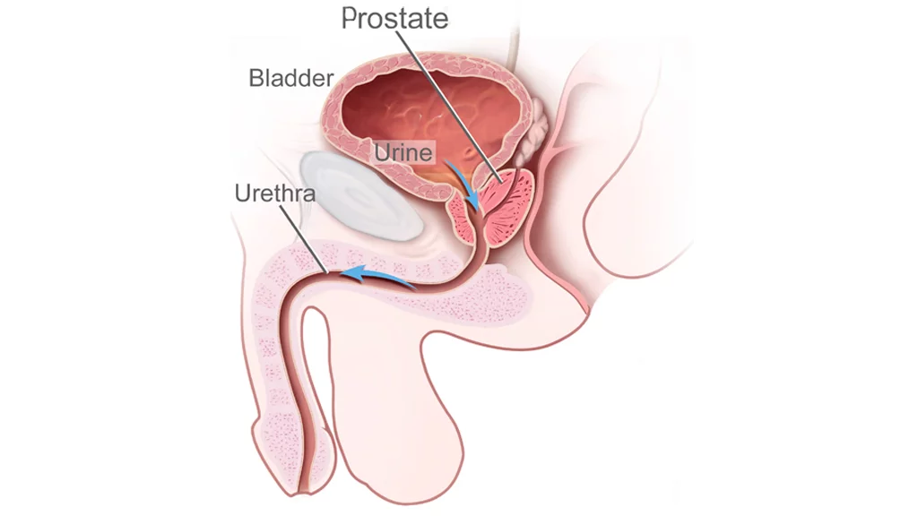 Male urinary anatomy illustration showing the flow of urine from the bladder through the urethra