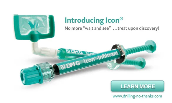 Homepage for DMG's Icon cavity infiltration system