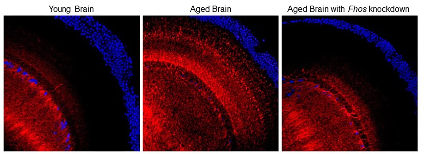 F-actin in young (left) and old (middle) fruit fly brains. When the Fsoh gene is knocked out, F-actin returns to a youthful state (right).