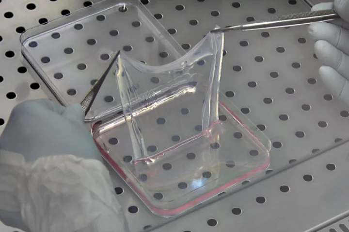The genetically modified, laboratory-grown skin that saved a young boy's life