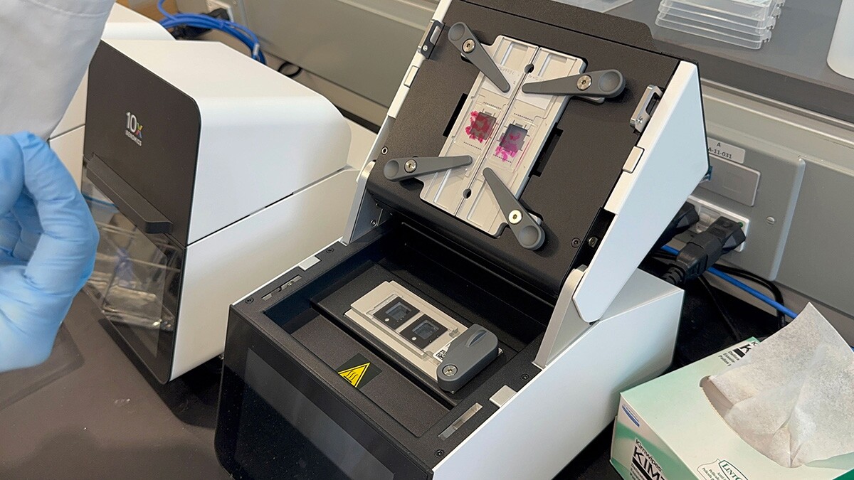 A spatial transcriptomics machine holds a slide containing human clinical-trial brain tissue