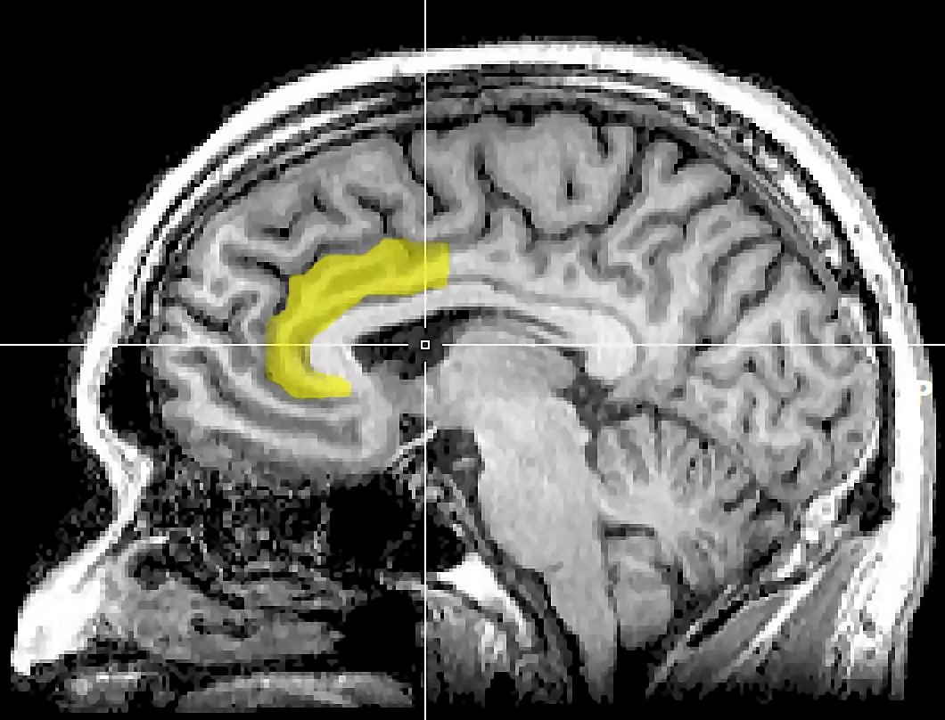 MRI of metabolic activity in the cingulate cortex; the anterior region is the curved portion of the hook (Photo: Geoff B Hall)