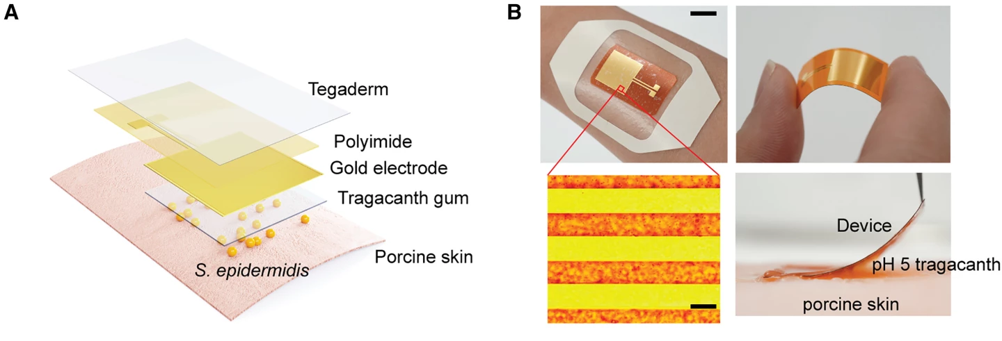 For this study, the bioelectronic patch was applied on pork skin, along with a hydrogel to create an acidic environment for bacterial excitability