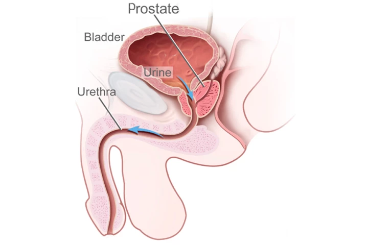 Male urinary anatomy illustration showing the flow of urine from the bladder through the urethra