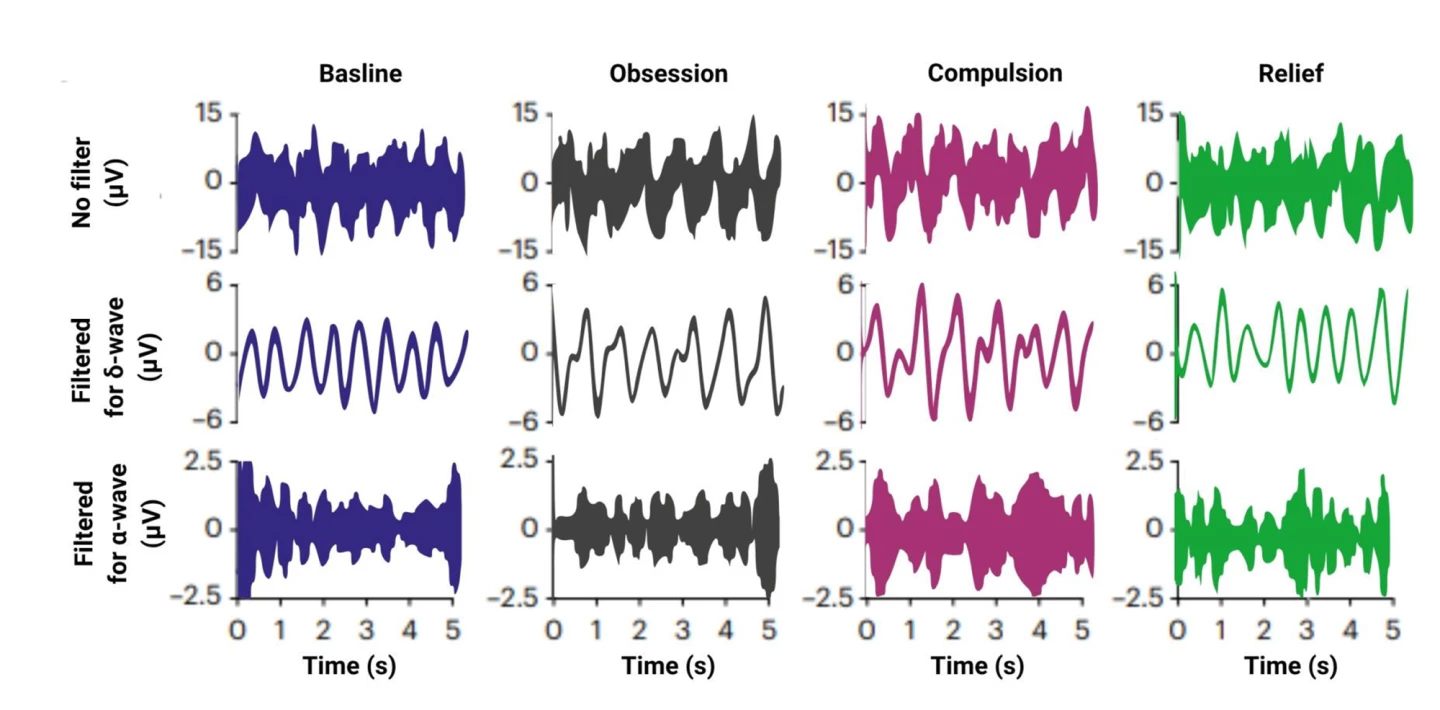 Alpha (⍺) and delta (δ) brainwaves appeared relatively frequently across the entire brain network during the study