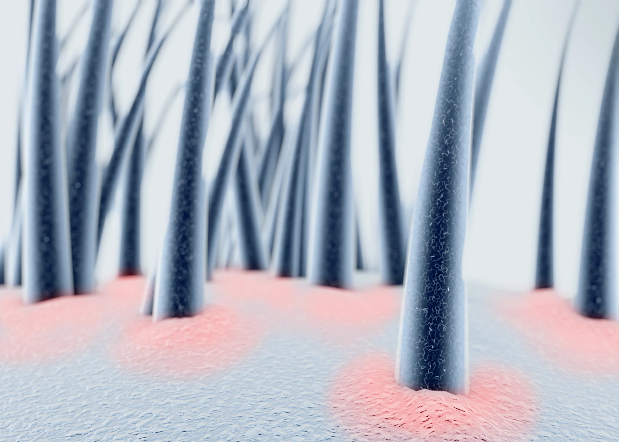 A breakthrough in hair follicle research may pave the way towards new treatment for hair loss disorders