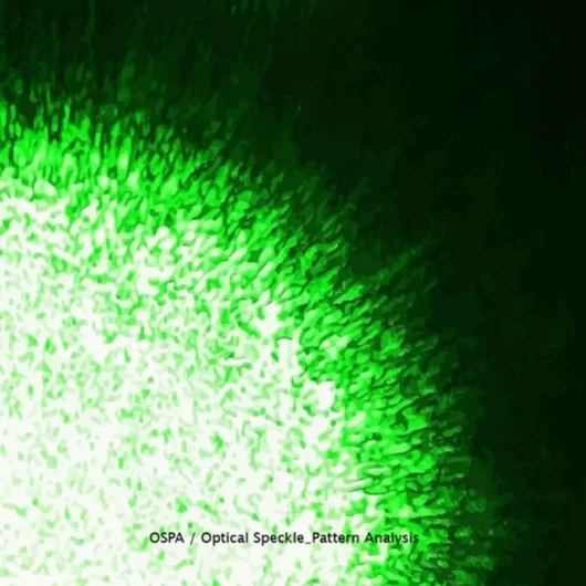 SPA - optical speckle pattern analysis