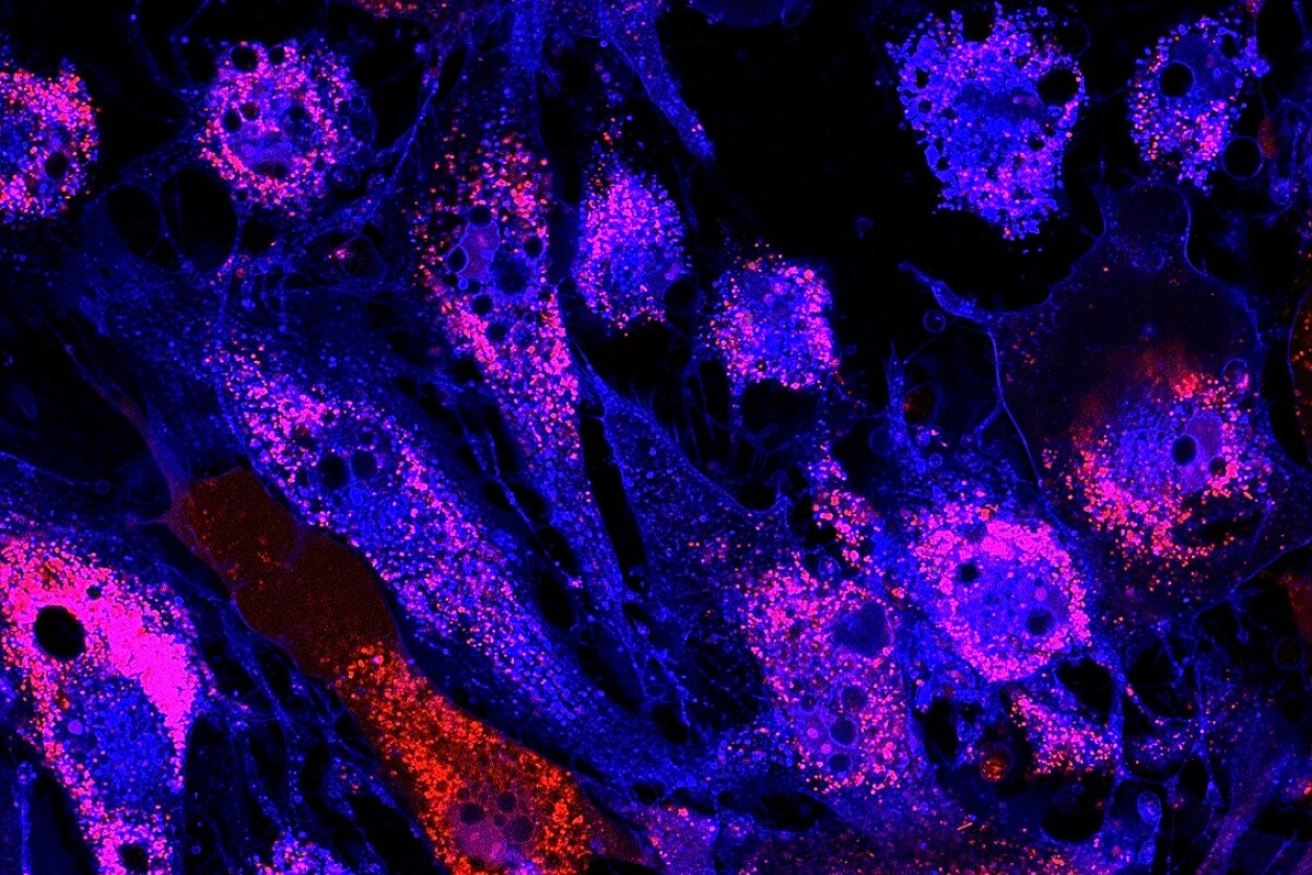 A landmark stem cell therapy to treat frailty in senior citizens is all set to move into the final phase of human clinical trials