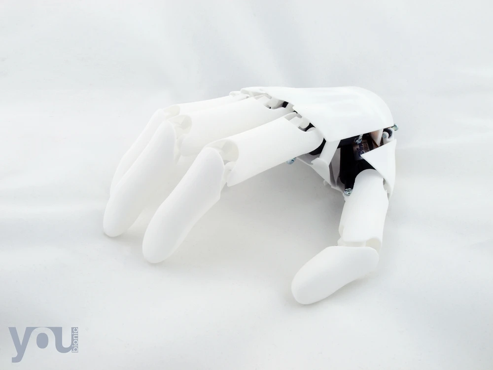 Youbionic says its hands will cost around €1,000, a fraction of the price of current commercial products