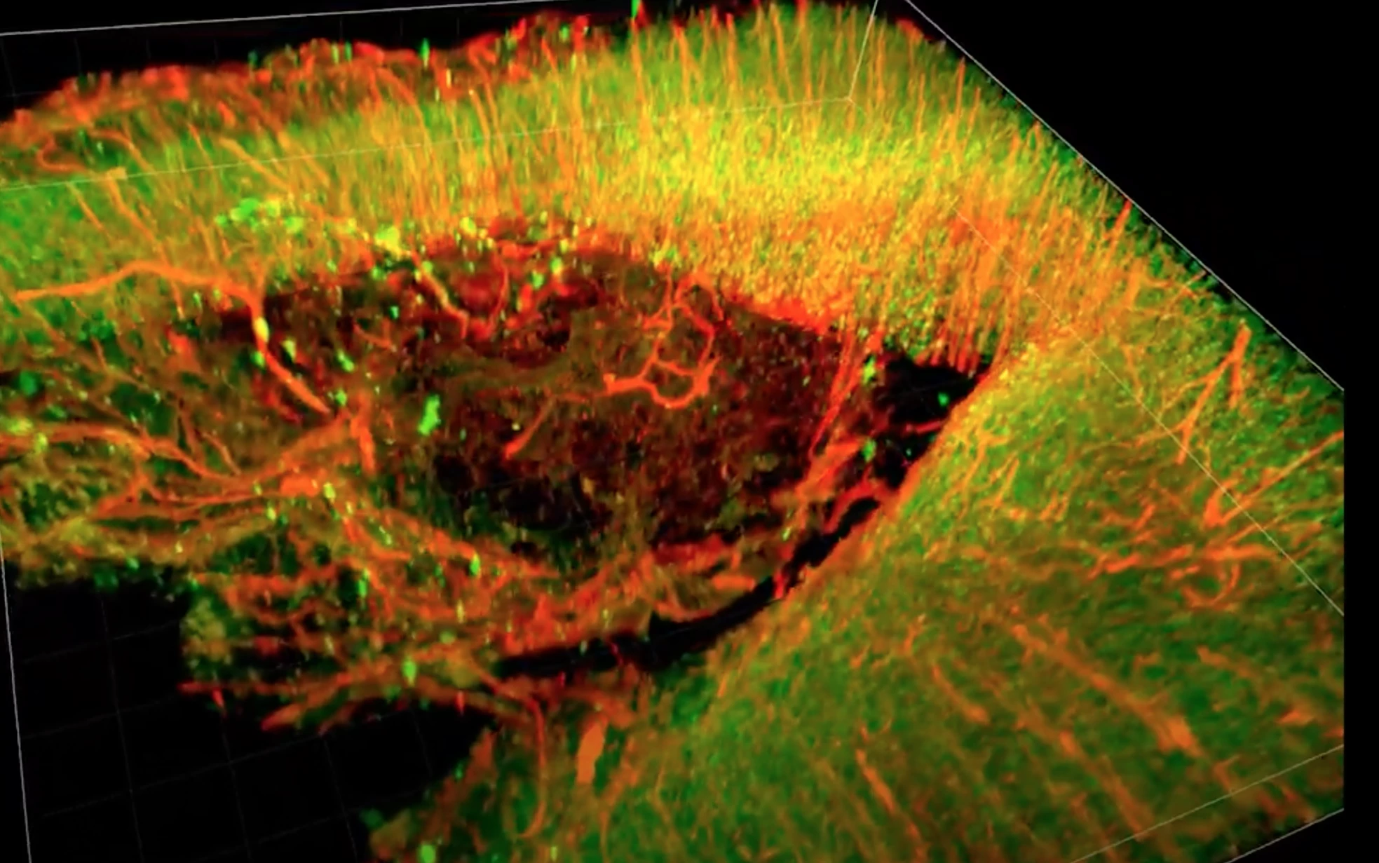 A 3D image of a recovering injured rat brain treated with a newly developed "brain glue"