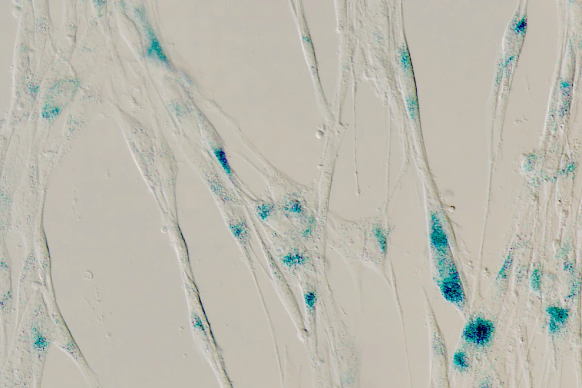 Senescent cells under a microscope, with the blue regions indicating an increase in the production of the gene CD36