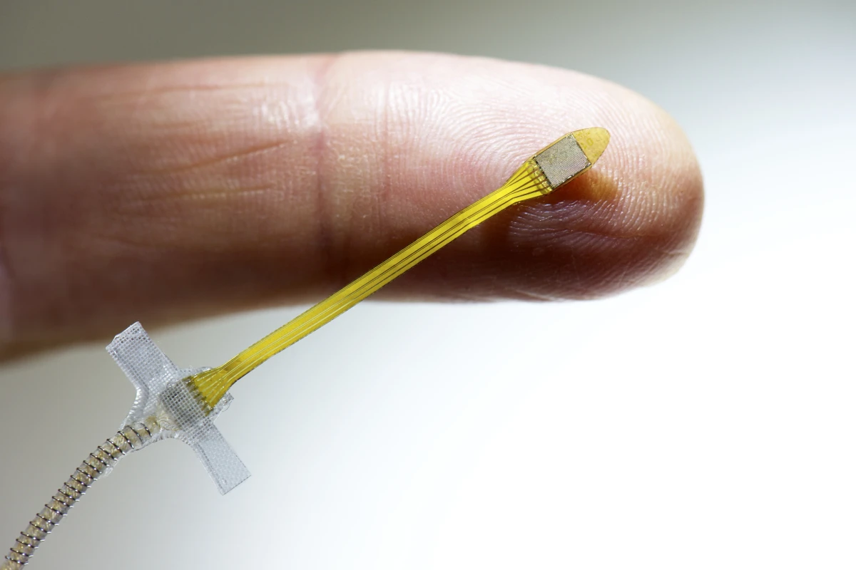 Retinal implant with power cable (Image: Retinal Implant AG)