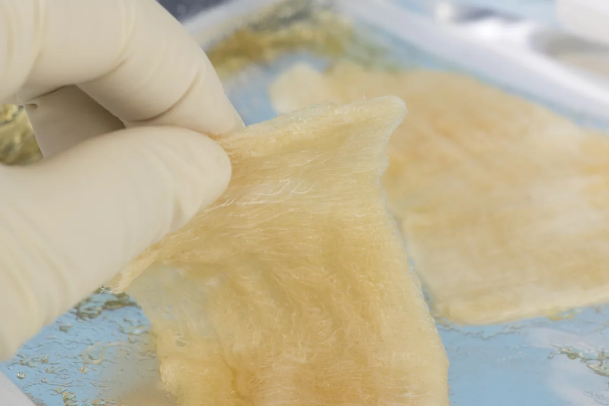 Bioengineers have developed a new protein-based gel (not pictured) that mimics many of the properties of elastic tissue when exposed to light