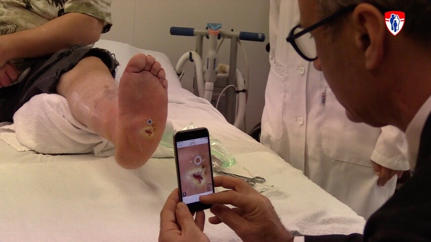 The Swift Skin and Wound app uses a smartphone's camera to compare the current area of a wound to a marker of a known size, which is placed upon the skin