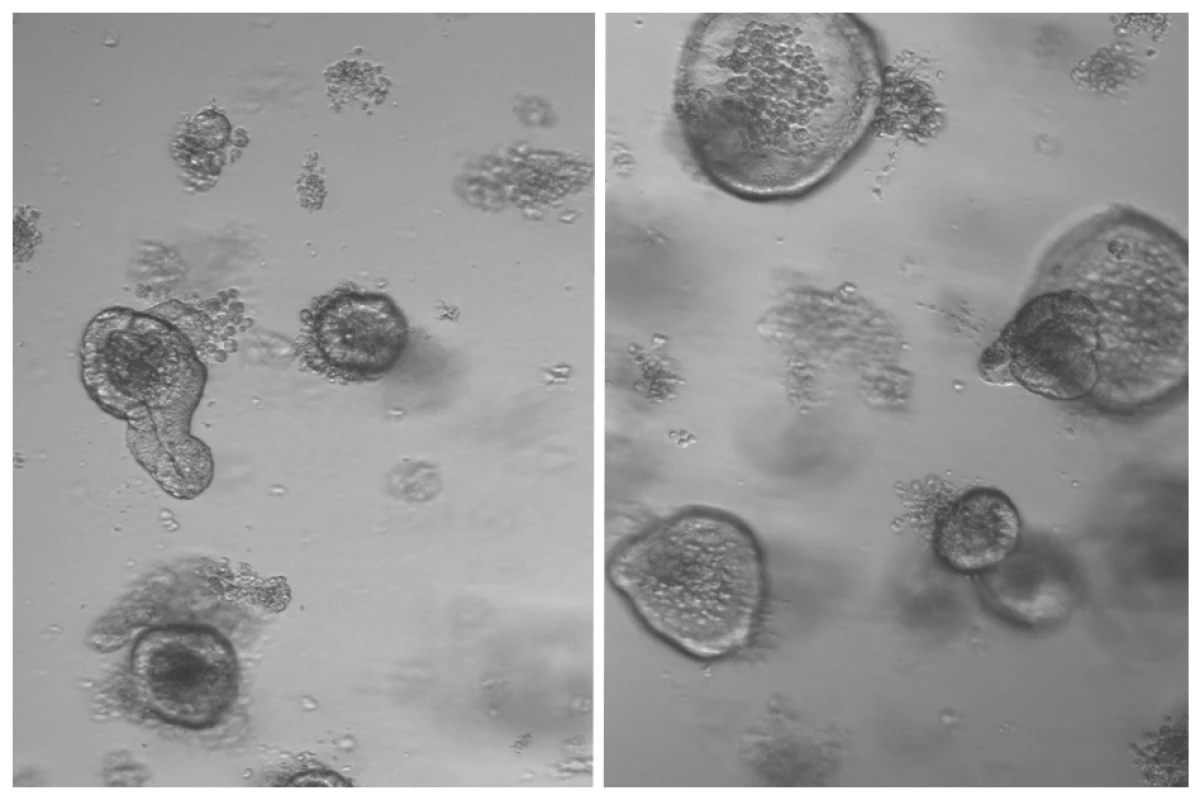The regenerative capabilities of intestinal stem cells were found to be double in mice that fasted (right), compared to a control group (left)