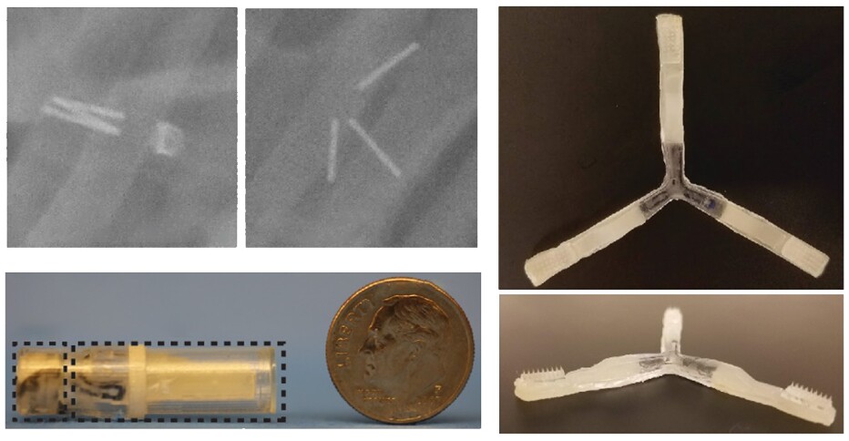 Top left: X-ray images show the drug-delivery capsule in the intestine, before and after the arms expand. Right: Arms unfolded to reveal the microneedles. Bottom left: The capsule with a dime for scale