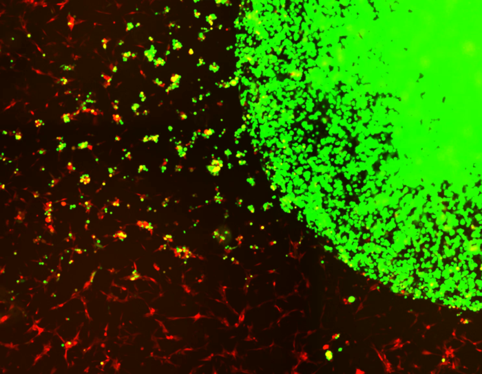 Engineered stem cells can be seen green, taking after the cancer cells seen in red