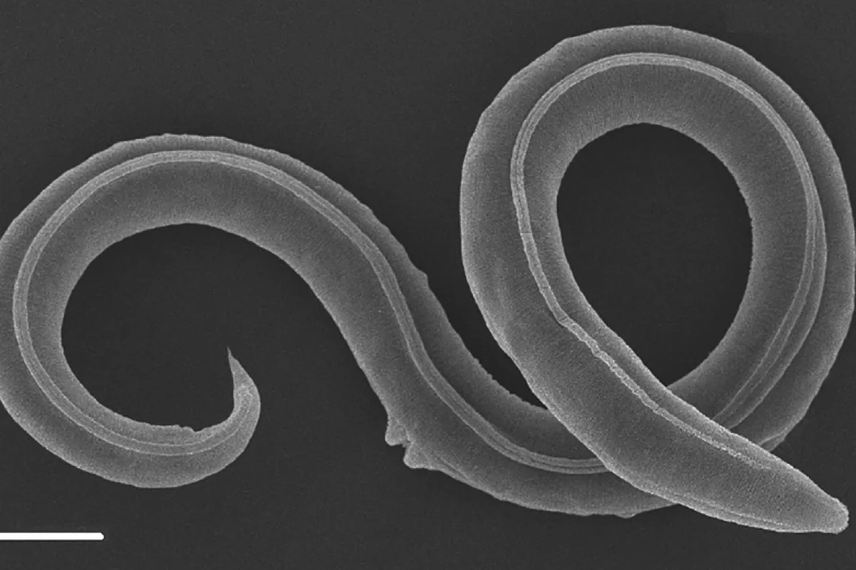 A microscope image of the newly described species, Panagrolaimus kolymaensis, which has been revived from 46,000-year-old permafrost