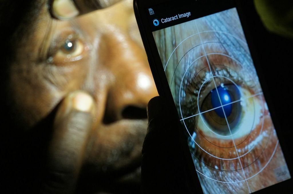 Peek is capable of several eye tests such as visual field, acuity (clearness of vision), color vision, contrast sensitivity, lens imaging for cataracts, retinal imaging and image grading (Photo: Peek)