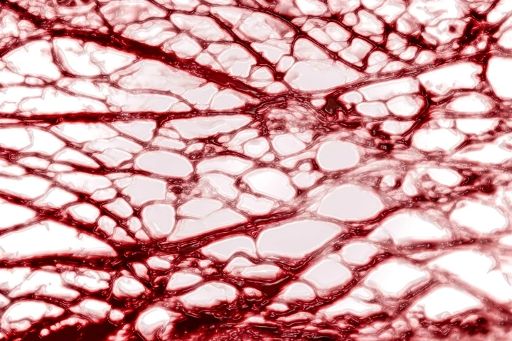 Researchers have developed a microbubble scrubber to blast away bacterial biofilms