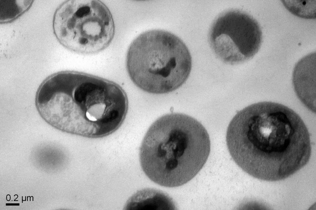 Normal cells of the Acinetobacter baumannii bacteria after treatment with the synthetic polymers, showing that the cytoplasmic substances within the bacterial cell membrane have precipitated, killing the bacteria