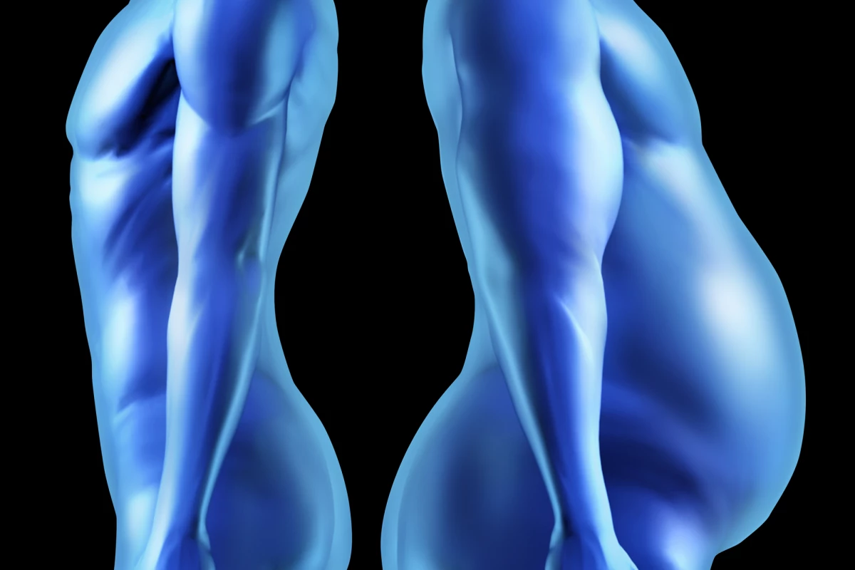 Studies continue to shed new light on the role genes play in weight gain in humans