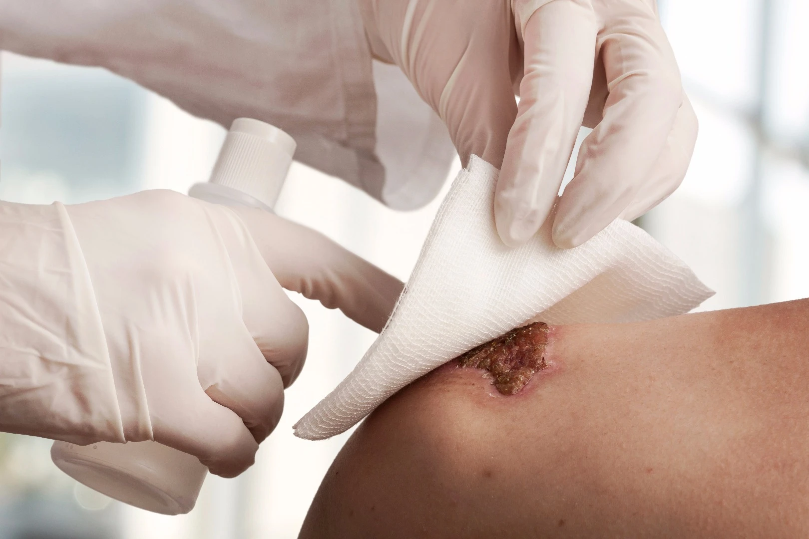 Future treatment of cuts and lacerations to the skin may involve electrical stimulation in addition to the old dressing and bandage