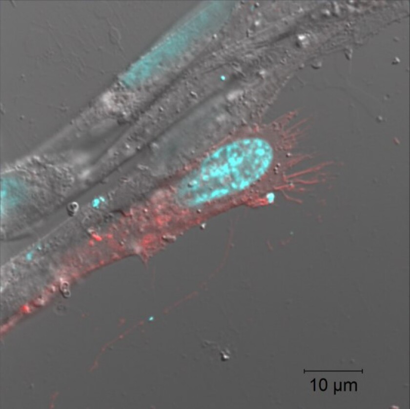 A fluorescence microscope image of a human lung fibroblast cell that's been engineered to overexpress the CD36 gene (red spots)