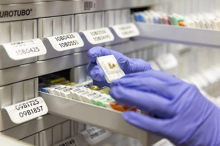 The world's first living biobank of brain samples has the potential to transform cancer research and treatment