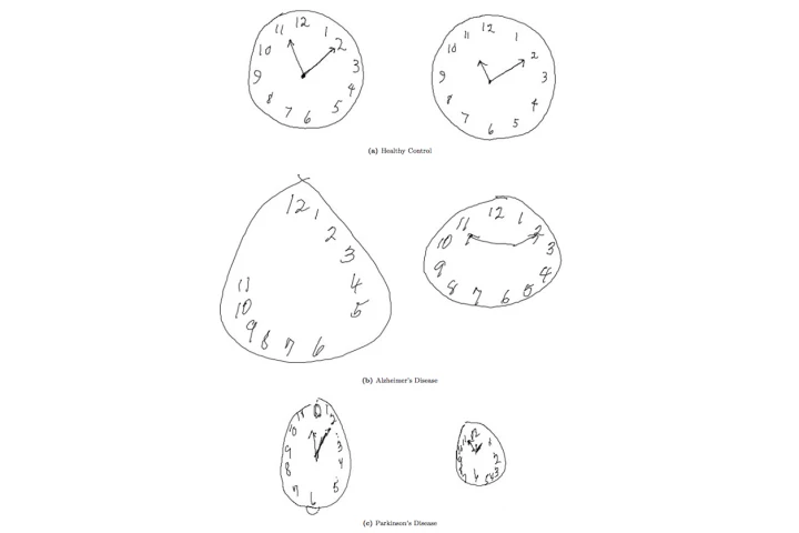 MIT researchers have updated the Clock Drawing Test (CDT) to the digital age