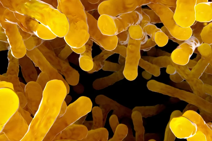A new study describes how the primary drug treatment for Parkinson's disease can be metabolized in the gut by a certain bacteria, reducing its overall efficacy and potentially increasing the chances of negative side effects