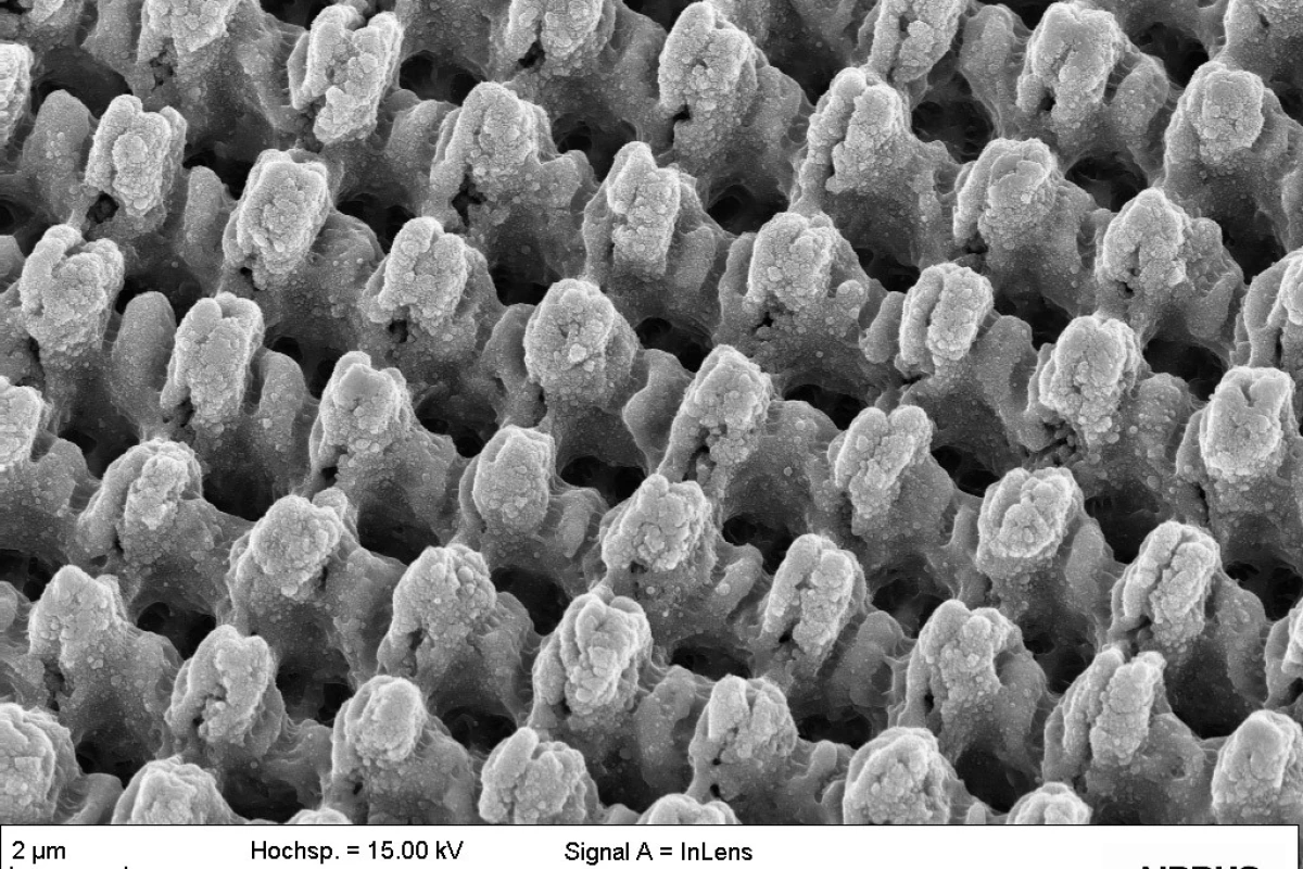 A microscope image of the lotus leaf-inspired surface treatment